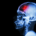 shutterstock_195100124 shutterstock_195100124