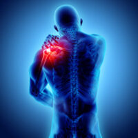 InjuredShoulder InjuredShoulder