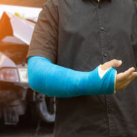 InjuredArm_Car InjuredArm_Car