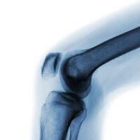 X-Ray8
